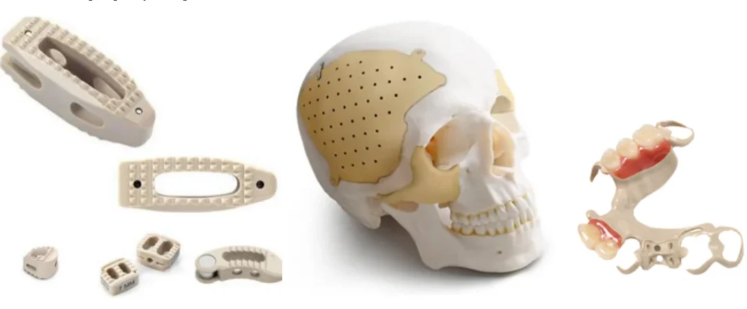 Implantable PEEK Exposed: The Powerhouse Material Behind Modern Implants