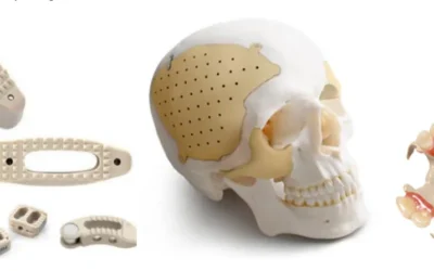Implantable PEEK Exposed: The Powerhouse Material Behind Modern Implants