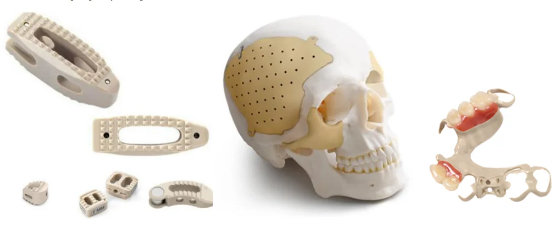 Implantable PEEK medical devices including cranial plates, spinal cages, and dental implants